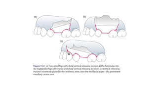 Flap Rib Design flap designs.pdf