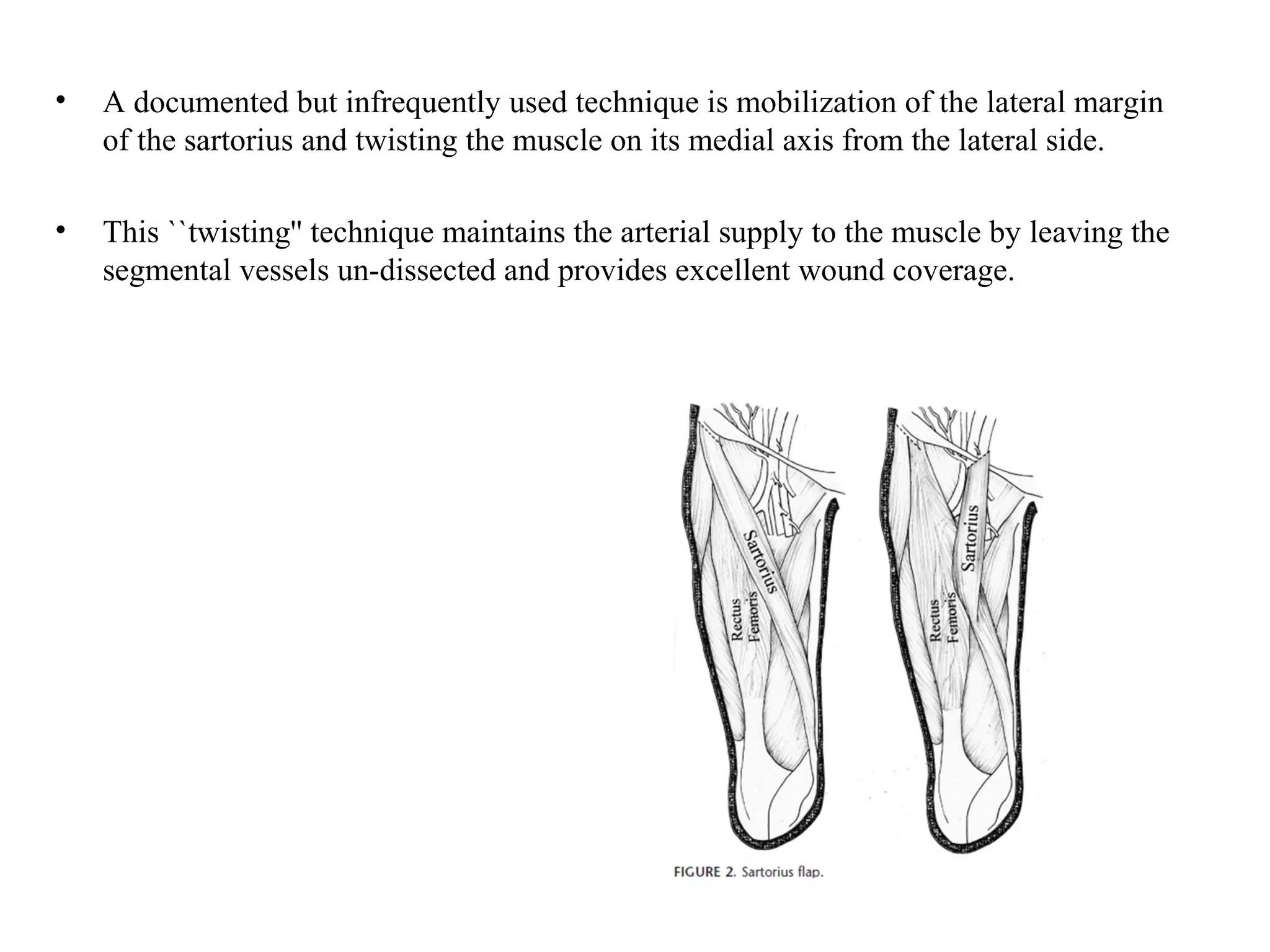 • A documented but infrequently used technique is mobilization of the lateral margin
of the sartorius and twisting the muscle on its medial axis from the lateral side.
• This ``twisting'' technique maintains the arterial supply to the muscle by leaving the
segmental vessels un-dissected and provides excellent wound coverage.
 
