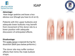 Advantage:
Have longer pedicles and leave a less-
obvious scar (though you have to sit on it).
Patients with thin upper buttocks and
adequate lower buttocks may benefit
from movement of the donor site to a
lower position with adequate
discussion of anticipated effects.
Disadvantage:
The sciatic nerve is exposed during the
dissection (Both pass below piriformis )
The donor site may suffer contour
effects that mimic the male buttock
shape.
IGAP
 
