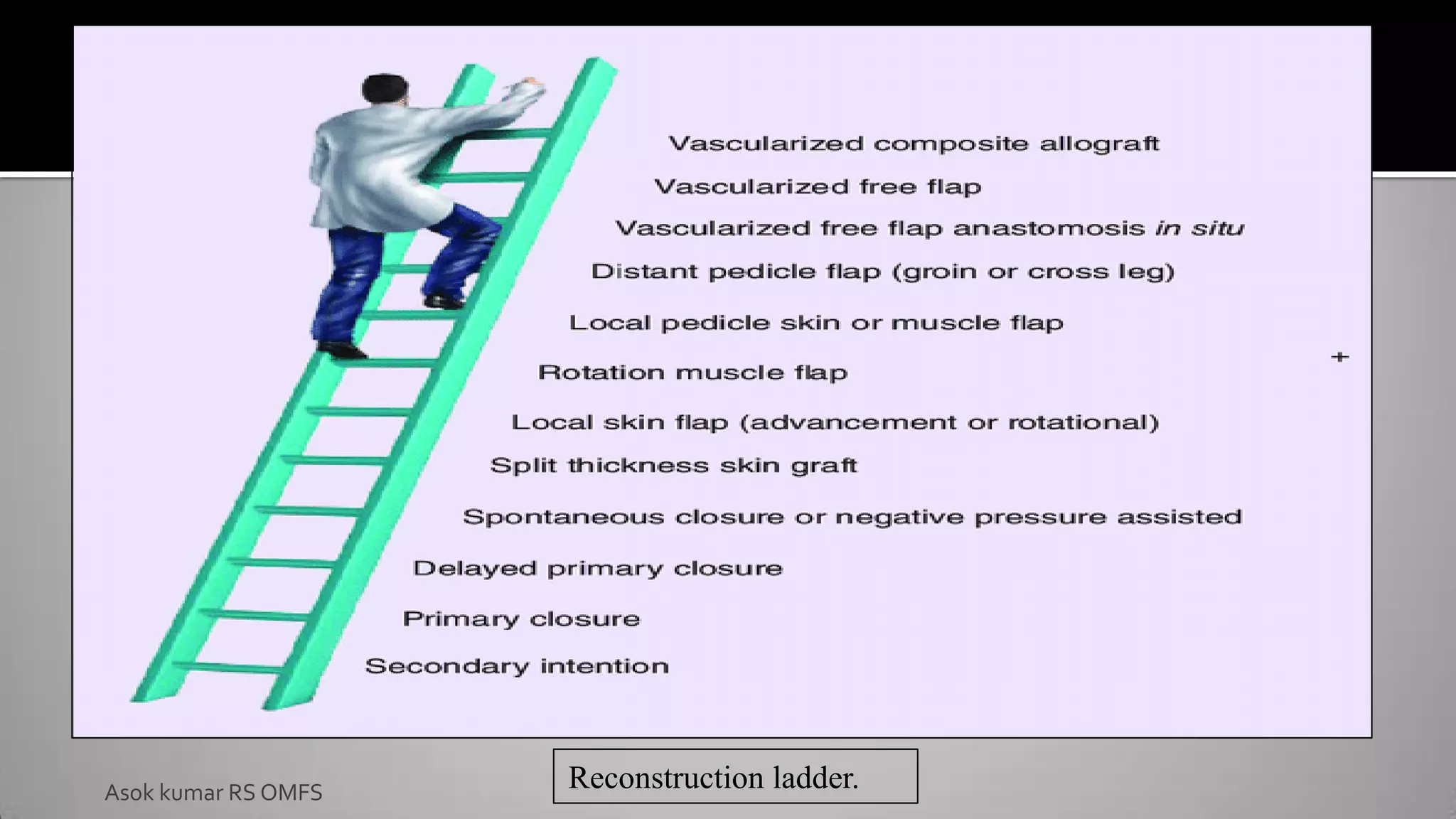 Reconstruction ladder.
Asok kumar RS OMFS
 