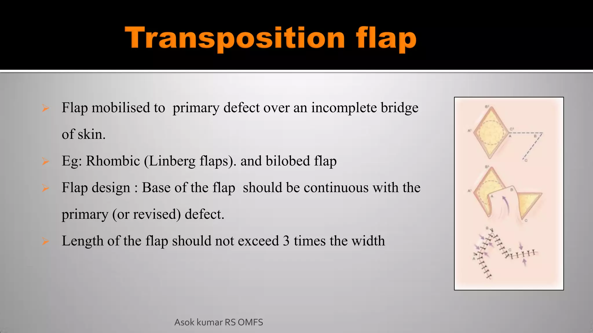 Flap mobilised to primary defect over an incomplete bridge
of skin.
 Eg: Rhombic (Linberg flaps). and bilobed flap
 Flap design : Base of the flap should be continuous with the
primary (or revised) defect.
 Length of the flap should not exceed 3 times the width
Asok kumar RS OMFS
 