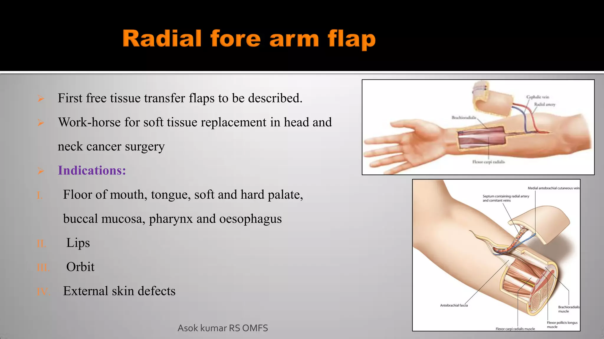  First free tissue transfer flaps to be described.
 Work-horse for soft tissue replacement in head and
neck cancer surgery
 Indications:
I. Floor of mouth, tongue, soft and hard palate,
buccal mucosa, pharynx and oesophagus
II. Lips
III. Orbit
IV. External skin defects
Asok kumar RS OMFS
 