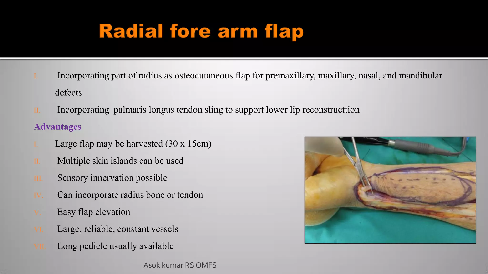 Asok kumar RS OMFS
I. Incorporating part of radius as osteocutaneous flap for premaxillary, maxillary, nasal, and mandibular
defects
II. Incorporating palmaris longus tendon sling to support lower lip reconstructtion
Advantages
I. Large flap may be harvested (30 x 15cm)
II. Multiple skin islands can be used
III. Sensory innervation possible
IV. Can incorporate radius bone or tendon
V. Easy flap elevation
VI. Large, reliable, constant vessels
VII. Long pedicle usually available
 