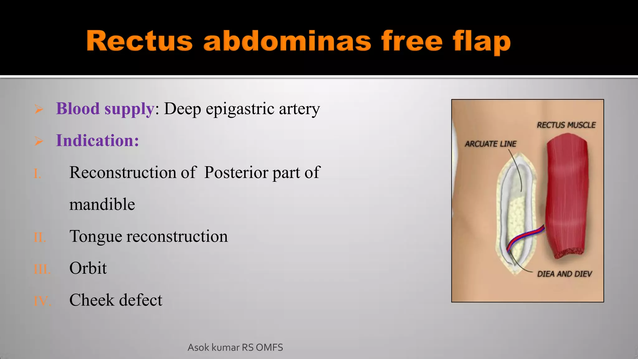  Blood supply: Deep epigastric artery
 Indication:
I. Reconstruction of Posterior part of
mandible
II. Tongue reconstruction
III. Orbit
IV. Cheek defect
Asok kumar RS OMFS
 