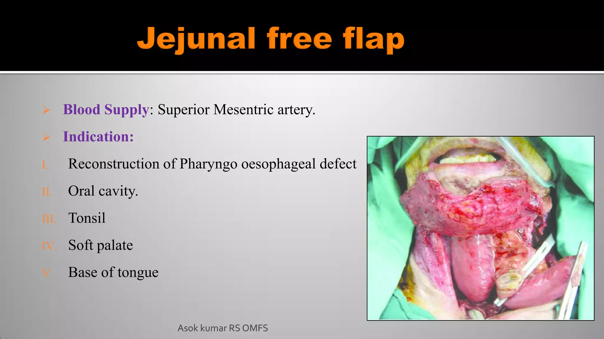  Blood Supply: Superior Mesentric artery.
 Indication:
I. Reconstruction of Pharyngo oesophageal defect
II. Oral cavity.
III. Tonsil
IV. Soft palate
V. Base of tongue
Asok kumar RS OMFS
 
