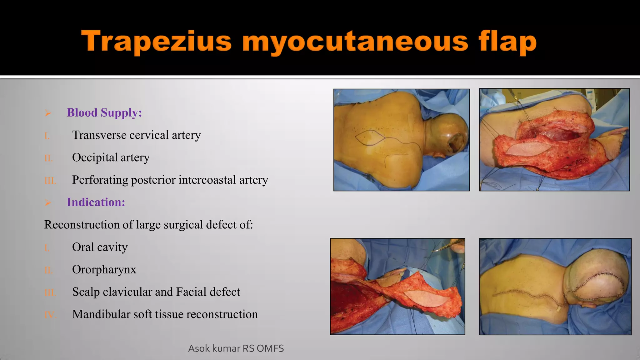  Blood Supply:
I. Transverse cervical artery
II. Occipital artery
III. Perforating posterior intercoastal artery
 Indication:
Reconstruction of large surgical defect of:
I. Oral cavity
II. Ororpharynx
III. Scalp clavicular and Facial defect
IV. Mandibular soft tissue reconstruction
Asok kumar RS OMFS
 