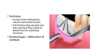 Comprehensive Guide to Soft-Tissue Flap Techniques for Implant ...