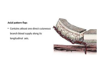 Comprehensive Overview of Flaps and Their Classification in ...