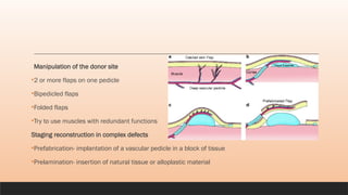 Pedicle Flaps Example Comprehensive Overview of Flap Surgery: Anatomy, Classification, and ...