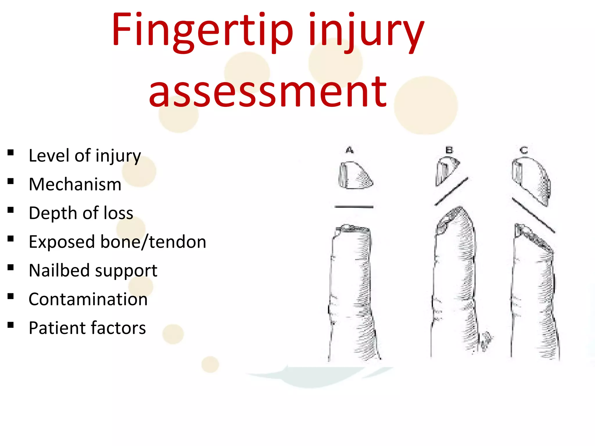 Fingertip injury
              assessment
   Level of injury
   Mechanism
   Depth of loss
   Exposed bone/tendon
   Nailbed support
   Contamination
   Patient factors
 