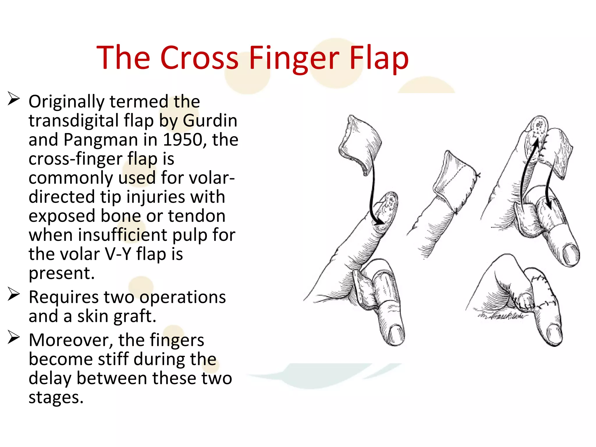 The Cross Finger Flap
 Originally termed the
  transdigital flap by Gurdin
  and Pangman in 1950, the
  cross-finger flap is
  commonly used for volar-
  directed tip injuries with
  exposed bone or tendon
  when insufficient pulp for
  the volar V-Y flap is
  present.
 Requires two operations
  and a skin graft.
 Moreover, the fingers
  become stiff during the
  delay between these two
  stages.
 