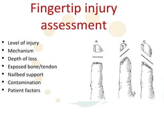 Fingertip injury
              assessment
   Level of injury
   Mechanism
   Depth of loss
   Exposed bone/tendon
   Nailbed support
   Contamination
   Patient factors
 