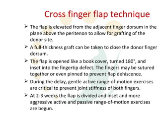 Cross finger flap technique
 The flap is elevated from the adjacent finger dorsum in the
  plane above the peritenon to allow for grafting of the
  donor site.
 A full-thickness graft can be taken to close the donor finger
  dorsum.
 The flap is opened like a book cover, turned 180°, and
  inset into the fingertip defect. The fingers may be sutured
  together or even pinned to prevent flap dehiscence.
 During the delay, gentle active range-of-motion exercises
  are critical to prevent joint stiffness of both fingers.
 At 2-3 weeks the flap is divided and inset and more
  aggressive active and passive range-of-motion exercises
  are begun.
 