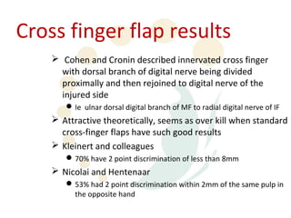 Cross finger flap results
     Cohen and Cronin described innervated cross finger
      with dorsal branch of digital nerve being divided
      proximally and then rejoined to digital nerve of the
      injured side
        Ie ulnar dorsal digital branch of MF to radial digital nerve of IF
     Attractive theoretically, seems as over kill when standard
      cross-finger flaps have such good results
     Kleinert and colleagues
        70% have 2 point discrimination of less than 8mm
     Nicolai and Hentenaar
        53% had 2 point discrimination within 2mm of the same pulp in
         the opposite hand
 