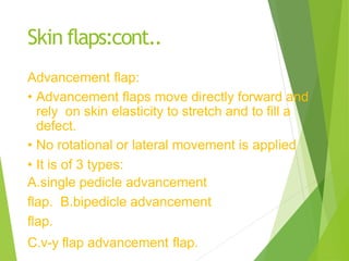 Flaps (2).pptx