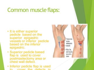 Flaps (2).pptx