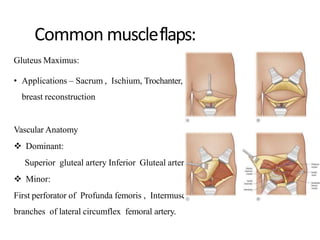Flaps and its classification | PPTX