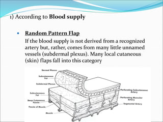 Random Pattern Flasps Flaps Basics and Important Leg Flaps and Trauma to Leg management | PPT