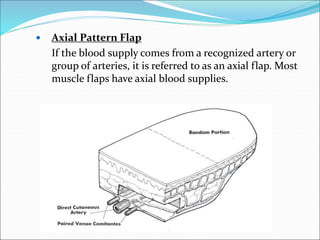 Flaps Basics and Important Leg Flaps and Trauma to Leg management | PPT
