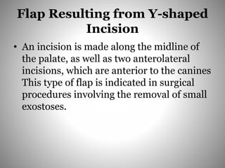 Flap Resulting from Y-shaped
Incision
• An incision is made along the midline of
the palate, as well as two anterolateral
incisions, which are anterior to the canines
This type of flap is indicated in surgical
procedures involving the removal of small
exostoses.
 