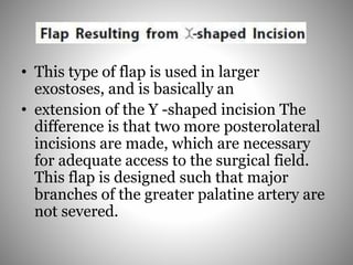 • This type of flap is used in larger
exostoses, and is basically an
• extension of the Y -shaped incision The
difference is that two more posterolateral
incisions are made, which are necessary
for adequate access to the surgical field.
This flap is designed such that major
branches of the greater palatine artery are
not severed.
 