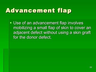 Advancement flap Use of an advancement flap involves mobilizing a small flap of skin to cover an adjacent defect without using a skin graft for the donor defect.  