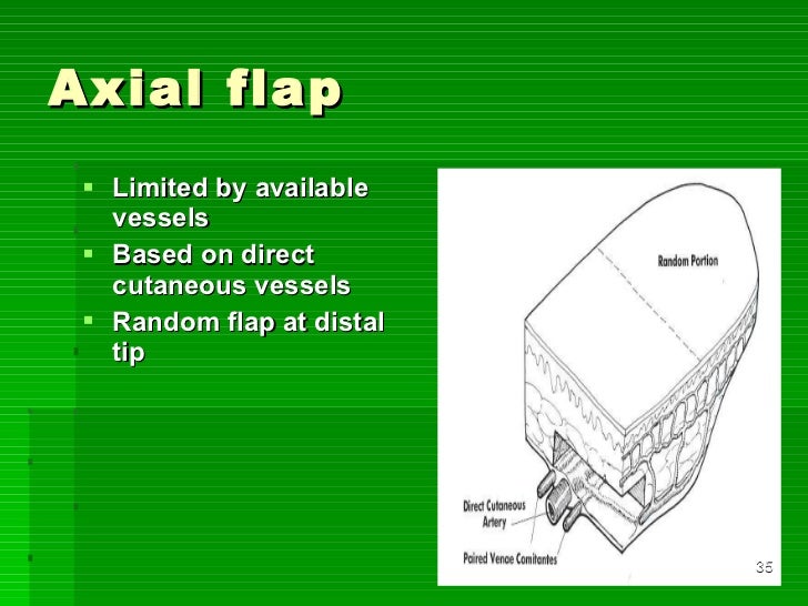 Flaps in orthopaedics