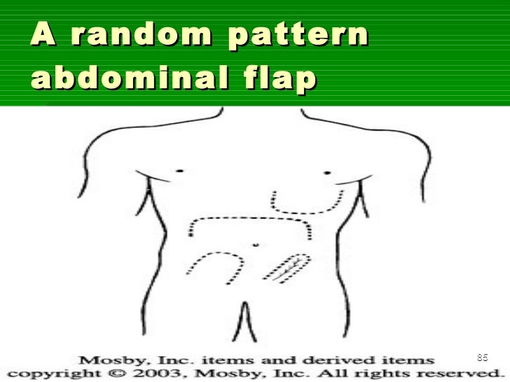 Flaps in orthopaedics