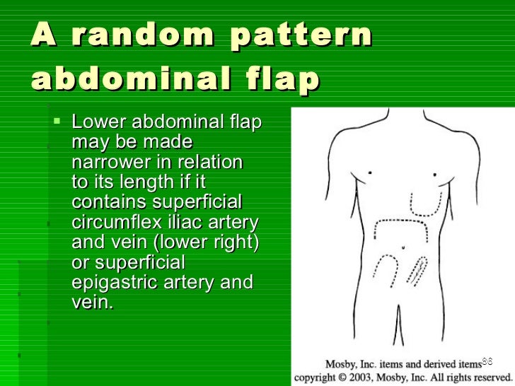 Flaps in orthopaedics