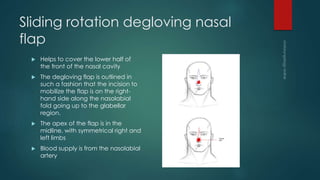 Flaps in otolaryngology | PPTX