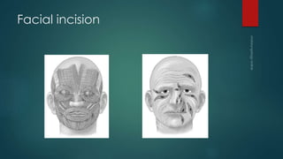 Flaps in otolaryngology | PPTX