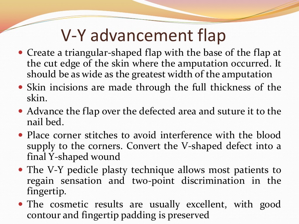 Flaps in plastic surgery