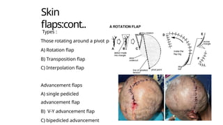 Transposition Vs Rotation Flap FLAPS IN PLASTIC SURGERY Pokhara academy of Health sciences | PPTX