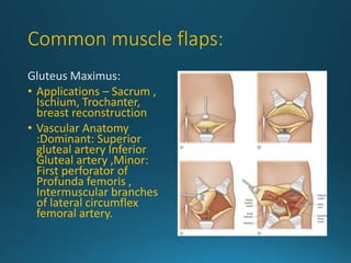 Flaps in surgery | PPTX