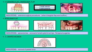 MASTERING FLAPS IN ORAL & MAXILLOFACIAL SURGERY | PDF