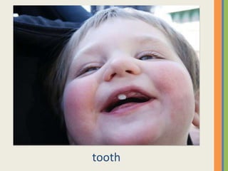 tooth