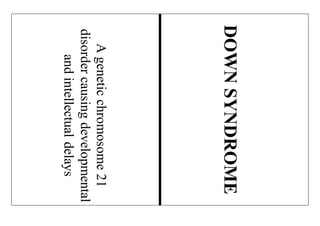 Ageneticchromosome21
disordercausingdevelopmental
andintellectualdelays
DOWNSYNDROME
 
