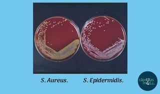 S. Aureus. S. Epidermidis.
 