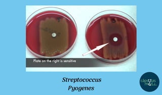 Streptococcus
Pyogenes
 