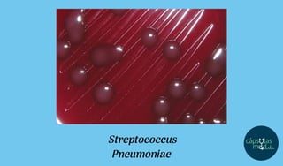 Streptococcus
Pneumoniae
 