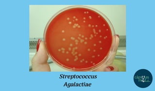 Streptococcus
Agalactiae
 