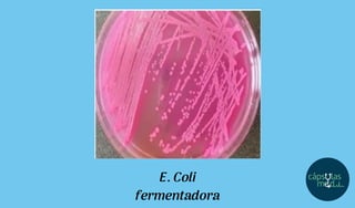 E. Coli
fermentadora
 