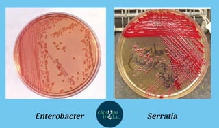 Enterobacter Serratia
 