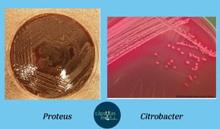 Proteus Citrobacter
 
