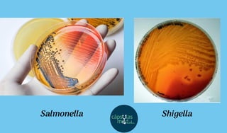 Salmonella Shigella
 