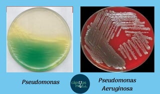 Pseudomonas Pseudomonas
Aeruginosa
 