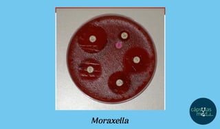 Moraxella
 
