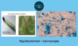 Mycobacterium + microscopía
 