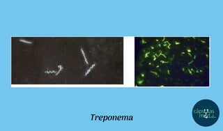 Treponema
 