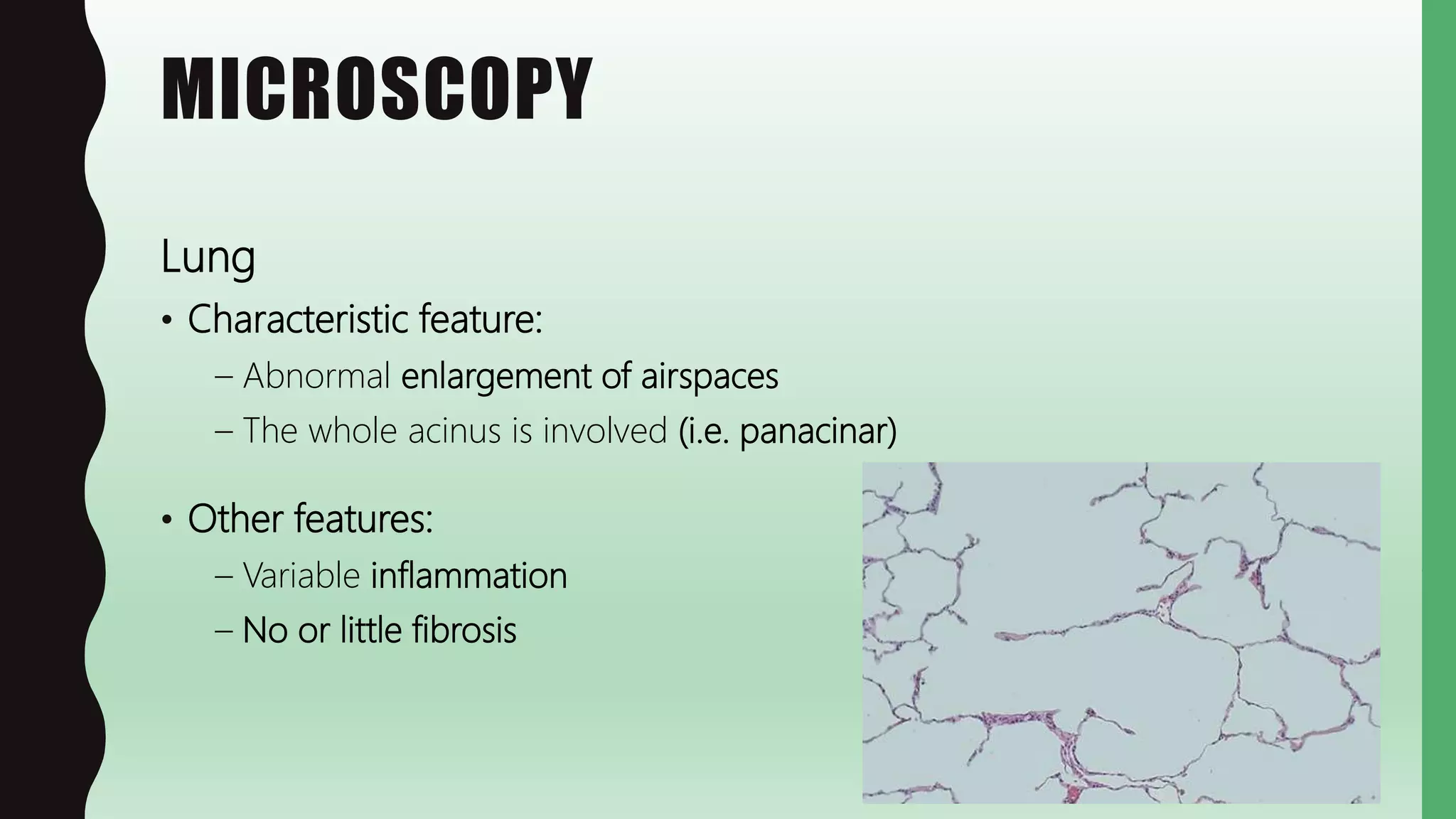 MICROSCOPY
Lung
• Characteristic feature:
– Abnormal enlargement of airspaces
– The whole acinus is involved (i.e. panacinar)
• Other features:
– Variable inflammation
– No or little fibrosis
 